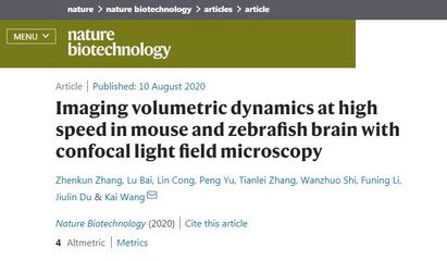 給大腦抓拍個(gè)工作照 新技術(shù)高速捕捉神經(jīng)元活動(dòng)與血流動(dòng)態(tài)